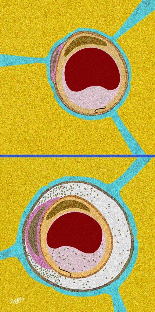 Illustrative artwork by Dr Rick Nelms