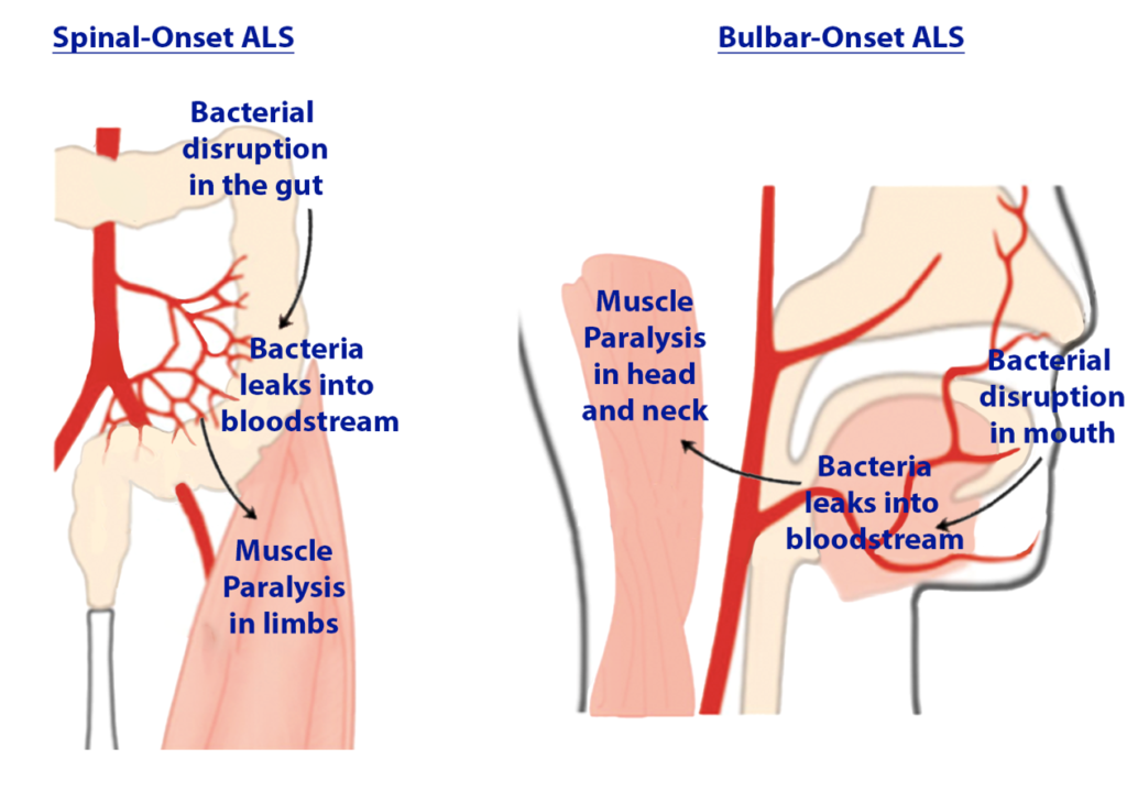 Bacterial imbalances in the mouth and gut as a therapeutic target in ALS